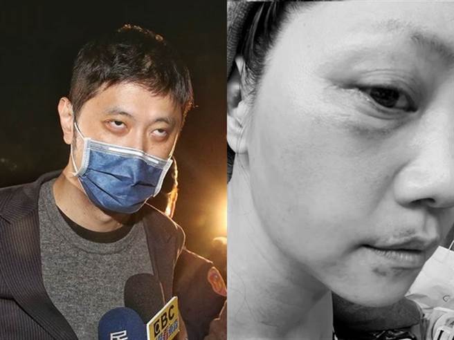 據了解林向檢方表示，當時只用手拍打高的頭部，且事後他「三跪九叩」道歉，2人當晚就和好，還泡澡共洗鴛鴦浴，內容與爆出的「痛毆整晚」相去甚遠。（中時資料照）