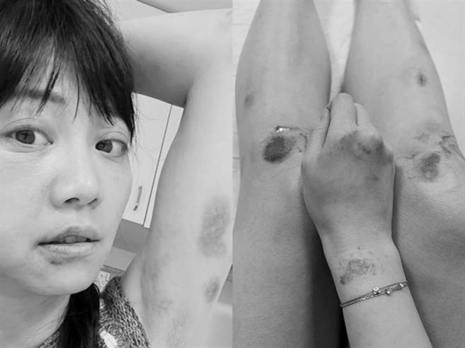 據了解林向檢方表示，當時只用手拍打高的頭部，且事後他「三跪九叩」道歉，2人當晚就和好，還泡澡共洗鴛鴦浴，內容與爆出的「痛毆整晚」相去甚遠。（中時資料照）