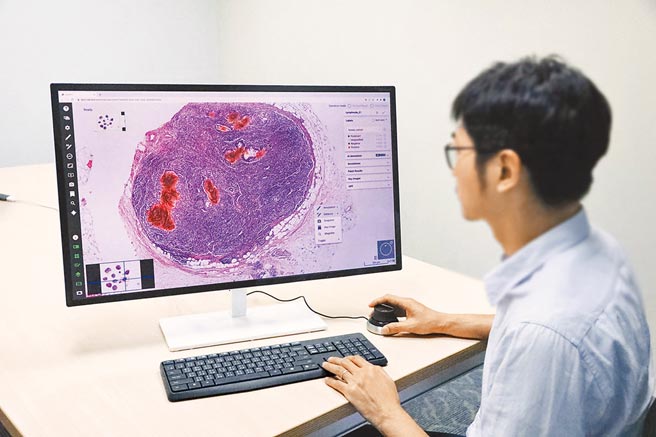 云象科技将AI应用导入包含大肠癌、肺癌等诊治，协助医师辅助诊断，以人机协作提升精准医疗。图／云象科技提供