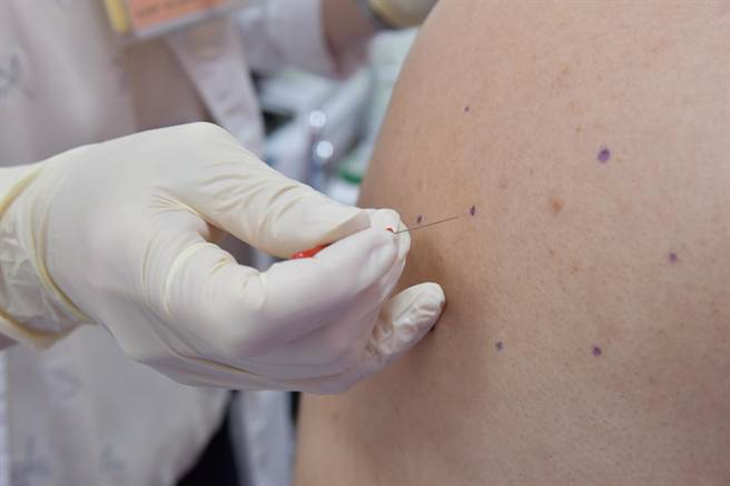 醫師江科郁表示，中醫針刀結合針灸針和微型手術刀的特點，刃狀針尖直徑僅0.6至1.2毫米不等，又稱「微創針刀」。（台中醫院提供／張妍溱台中傳真）