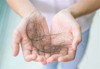 25到30歲掉髮族激增2倍 皮膚醫揪NG食物 真會越吃越禿