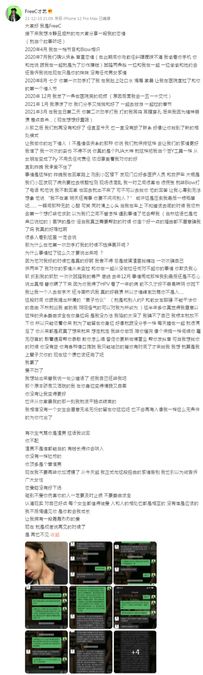 大陆饶舌女歌手晒出遭男友殴伤的照片。（图／微博）
