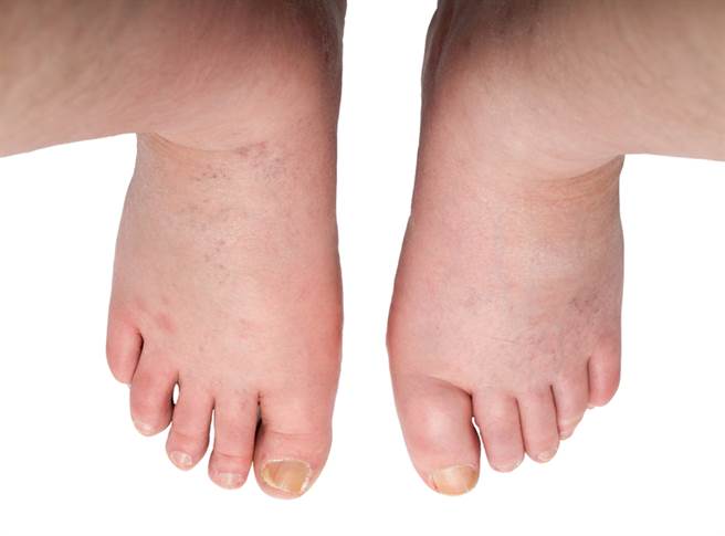 (示意图/常春月刊提供)