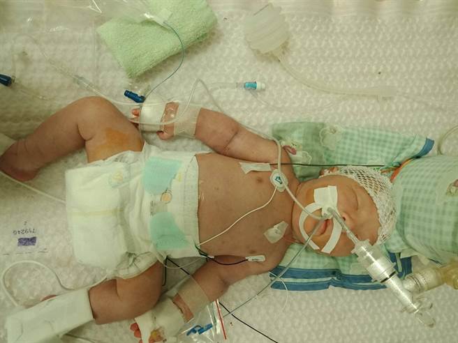 南投1名35岁洪姓妇人今年7月在南投馨生妇产科诊所生产，过程中难产院方用催生药物、真空吸引等方式进行催产，最后婴儿出生后不但没哭、洪妇也因为子宫破裂大出血，母婴两人紧急送医后婴儿脑麻、洪妇变成植物人。（翻摄脸书／吴建辉南投传真）