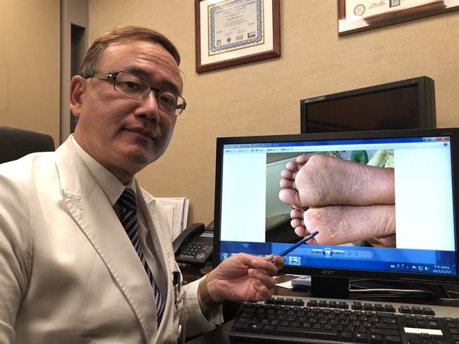 荣新诊所副院长潘俊伸提醒，家中幼儿发烧不断、皮肤陆续出现红斑、红疹、肿胀、脱皮等症状，即使温度稍退仍不要掉以轻心，小心可能是非典型川崎氏症。(图/荣新诊所提供)