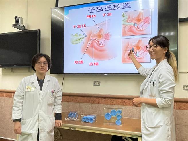 高雄荣总妇女医学部医师李如悦、侯咏龄示范「子宫托」置入位置及原理。（高雄荣总提供／袁庭尧高雄传真）