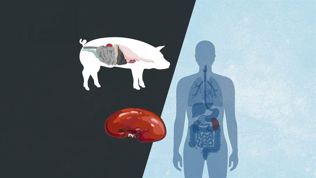 基因改造的猪，可能会成为器官移植的来源。图/vox(photo:ChinaTimes)