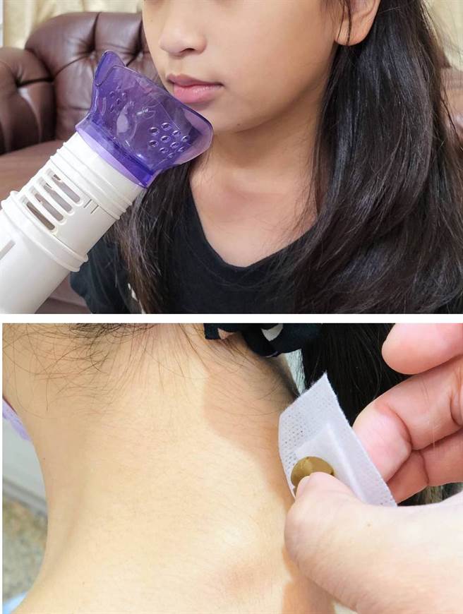 中医以薰鼻治疗(图上)与穴位敷贴(图下），舒缓过敏儿的症状。（图／埔心风泽中医诊所提供)