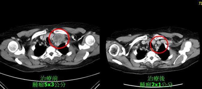 治疗前后比较图。（童综合医院提供／陈淑娥台中传真）