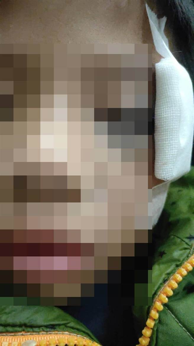 王姓學童奔跑與同學相撞受傷。（劉美芳服務處提供）
