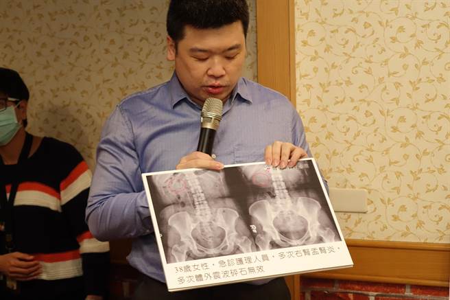屏东基督教医院引进软式输尿管镜碎石手术，除降低感染风险也减少肾臟损伤。（谢佳潾摄）