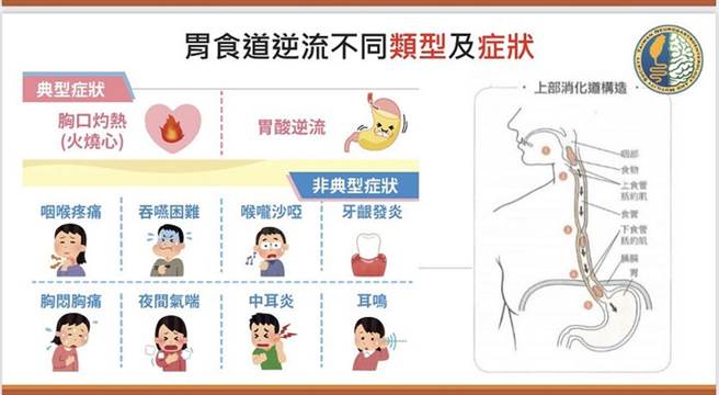 （图片来源 / 台湾胃肠神经与蠕动学会）
