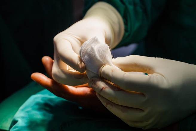 19岁少女戴戒指被剧烈撕扯，下秒7公分手指剩下「白骨」。（示意图／达志影像）