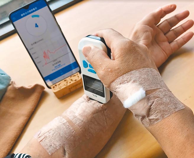 非侵入式血流感测器，盼未来让民眾在家也能自行操作，减去扎针之苦，也不必到大医院等候。（新光医院提供）