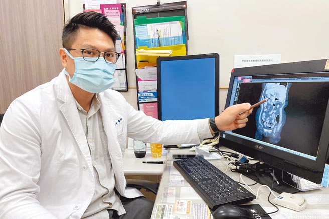 中医大新竹附医一般外科医师古君平，从电脑断层诊断陈妇罹患急性胆囊炎，更发现是内臟左右颠倒的「镜面人」。（罗浚滨摄）