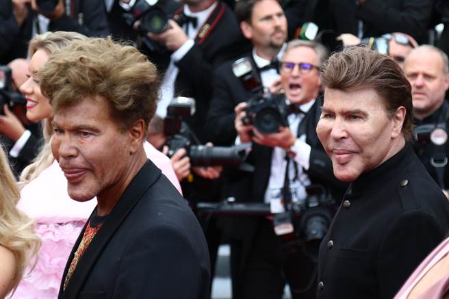 法國雙胞胎名人鮑格達諾夫兄弟（Bogdanoff brothers）沒打疫苗確診，雙雙不幸往生。（圖／達志）