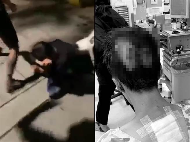 警方調查，雙方均認識，去年12月23日在屏東潮州發生言語爭執，回高雄後相約談判，未料4男對許男大打出手，警方全案依殺人未遂、妨害秩序罪嫌移送偵辦。(翻攝自臉書)