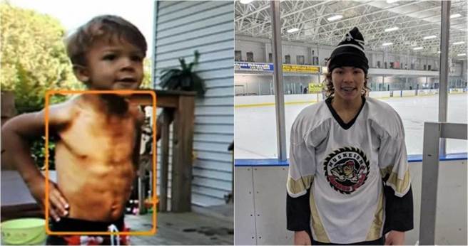 利亚姆儿时与现在的差异。(图翻摄自/脸书/Liam Hoekstra)