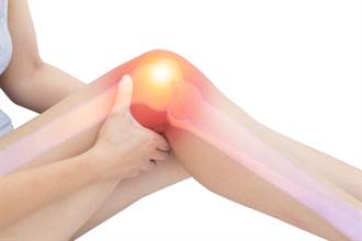 3類人膝關節最易耗損 中醫抓關鍵助修補