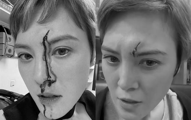 日前何慈茵自曝工作受伤，头撞玻璃后满脸血还缝8针，惊悚画面网友全看傻。(图/ 摘自何慈茵IG，画面已经变色处理)