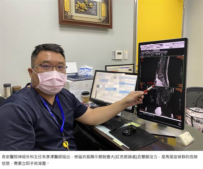 长安医院神经外科医师朱彦泽说，急性下背痛、排尿困难，当心罹患「急性马尾症候群」，随时把这些状况当作警讯、尽快就医。（长安医院提供／张妍溱台中传真）