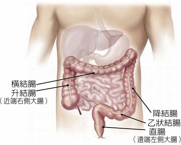 浅谈大肠癌    ˙图／新光医院提供
