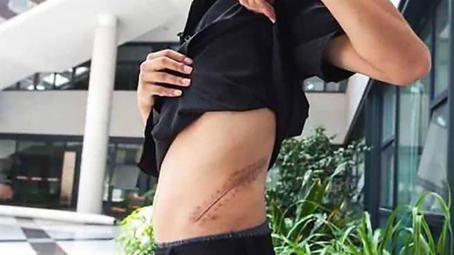 10年前，大陆安徽一名17岁王姓少年为了想要拥有iPhone手机，竟然跑去卖肾，如今悔不当初。（图／翻摄自网易）