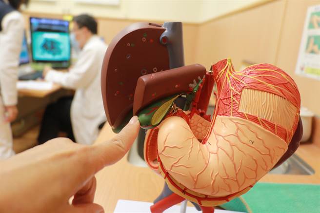 胆囊（手指位置）功能是储存浓缩肝臟制造多余的胆汁。（台中慈济医院提供／王文吉台中传真）