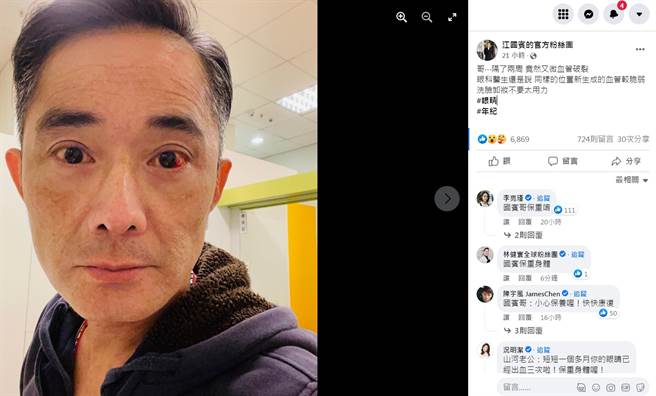 江国宾的眼球都是鲜血。（图／FB@江国宾）