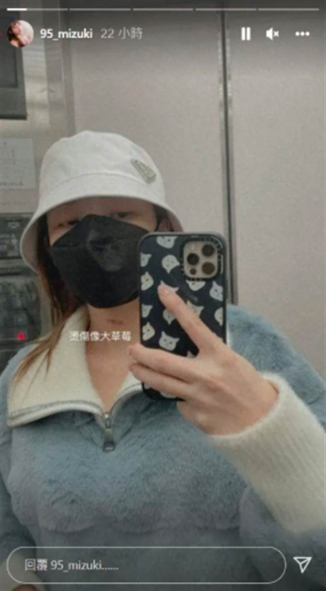 林襄素顏自拍秀脖子「草莓」。（圖／截取自林襄IG限時動態）
