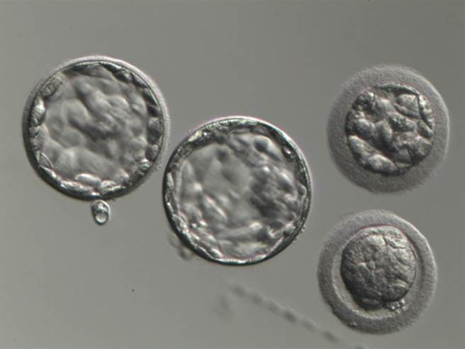 TFC台北妇产科诊所生殖中心内设有胚胎实验室里，培养到第5天的囊胚(见图)，试管婴儿可以透过AI人工智慧筛选掉品质不好、停止生长发育的胚胎。(TFC台北妇产科诊所生殖中心提供)