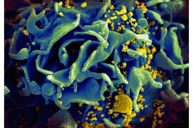 藍色的T細胞遭到黃色的HIV病毒攻擊。(圖/牛津大學)