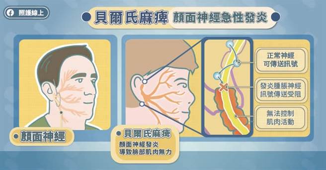 (图/照护线上提供)