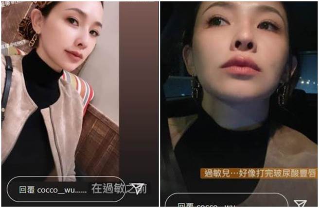 吳婉君曬出過敏前後的照片做對比。（ cocco__wu IG）