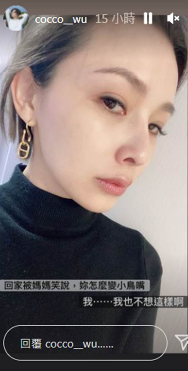 吳婉君過敏嘴巴紅腫，未料竟被媽媽嘲笑。（cocco__wu IG）