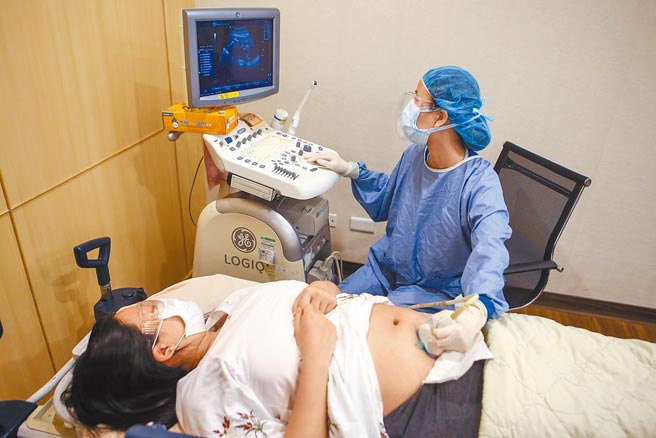 醫師提醒，人工生殖受孕國際趨勢，已朝每次植入1胚胎發展。圖為孕婦做超音波檢查。（非新聞當事人）（鄧博仁攝）