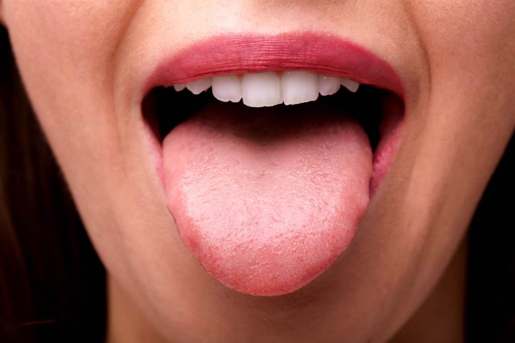 英国女子华勒丝（Olivia Wallace）在舌头上发现一颗肿块，原本以为是性病，让她羞于看医生，拖了7个月才就诊，竟确诊罹患舌癌，而且已经进入第四期。（示意图／shutterstock）(photo:ChinaTimes)