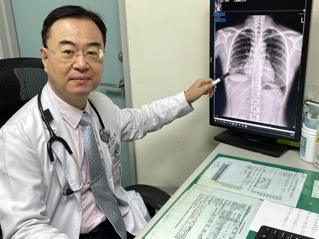 乌日林新医院胸腔内科医师许人文透过X光片，解释开放性肺结核的肺叶浸润情况。（乌日林新医院提供／林欣仪台中传真）