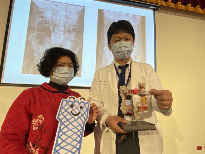 中国附医大肠直肠外科医师蔡元耀说，经紧急在赖女士肠阻塞处置入大肠金属支架，撑开肠道，让她可以排便、排气、正常饮食；待肠发炎状况缓解，再安排微创手术切除肿瘤。（冯惠宜摄）