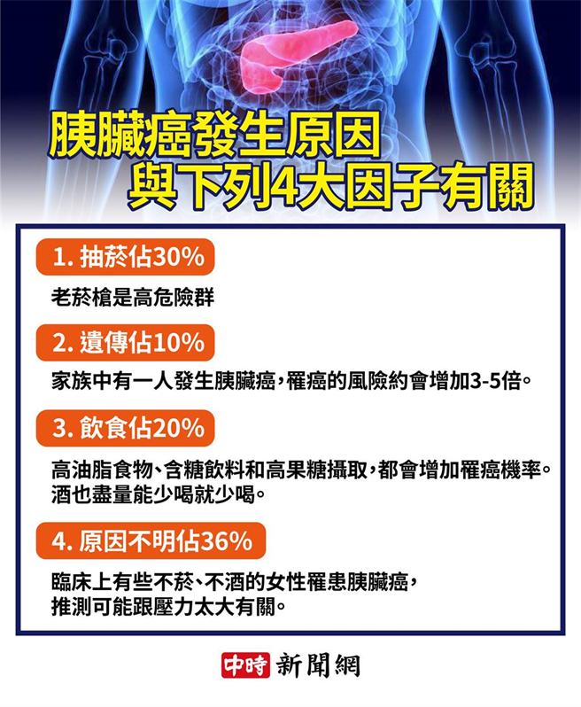 胰臟癌的发生原因通常与4大因子有关。(中时新闻网制表)