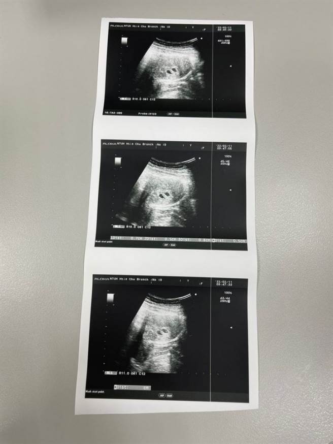 1名女网友在交友软体认识男友，某次喝醉后她让对方载去旅馆，当晚她在酒精催化下邀约发生关系，2人后来索性在一起，她后来发现意外怀了双胞胎。（翻摄自Dcard）