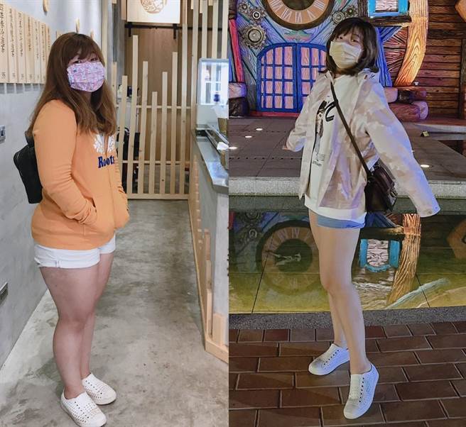 30岁护理师小芸接受高雄医学大学附设中和纪念医院体重管理中心协助，给予饮食调整及药物治疗，5个月后成功甩肉20公斤，椎间盘突出的疼痛问题也获得明显改善。（高医提供／袁庭尧高雄传真）