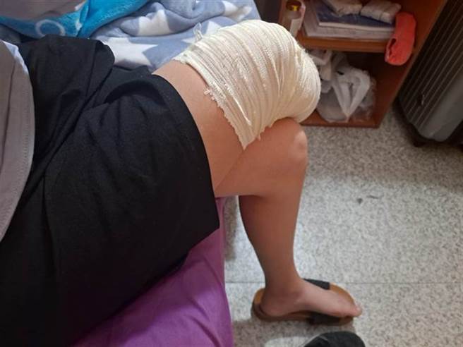 苗栗女子因職傷導致右腿截肢，無良老闆竟說：「截肢而已，不嚴重」，此話一出惹怒律師呂秋遠。（翻攝論壇PTT）