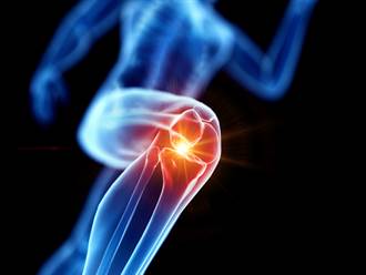 關節炎痛起來要命 專家推薦運動療法 可減輕20％疼痛感