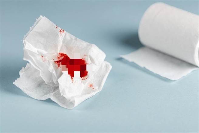 一名26岁女子下腹疼痛，如厕惊见马桶都是血，就医内诊时，医师一看吓傻。(示意图/达志影像)