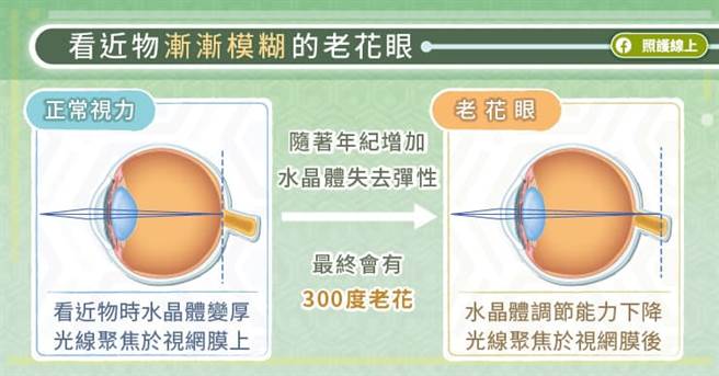 (圖/照護線上提供)