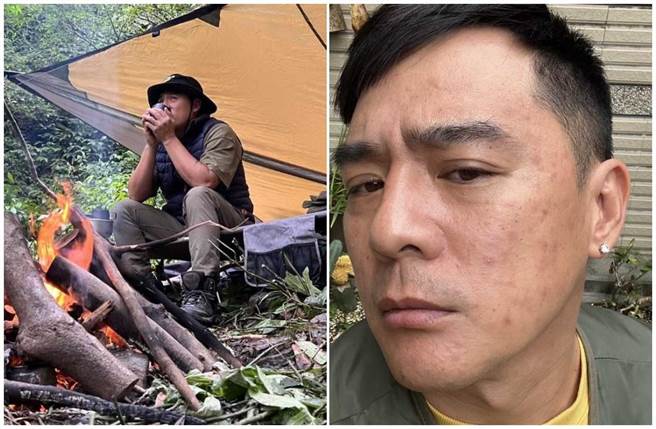 竇智孔前陣子全身起紅疹險進加護病房。（竇智孔提供）