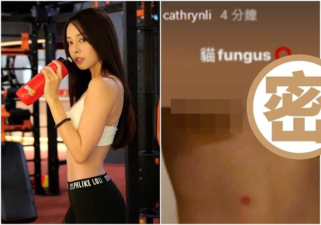 李元玲近期身体不适称长猫癣。（图/李元玲IG）