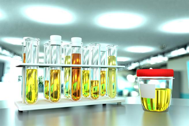 8种尿色是身体求救！ 医曝一招分辨蛋白尿。(示意图/Shutterstock)