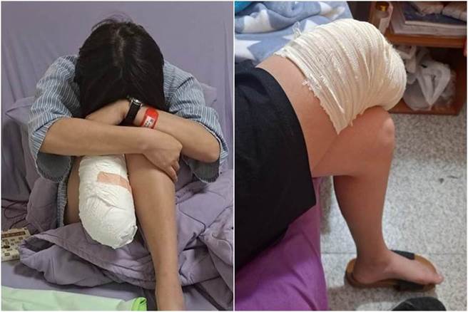 截肢女孩深夜發文「想念我的右腿」網心疼：表示難過時，可以哭，但記得很多人願意陪著你。(報系資料照)
